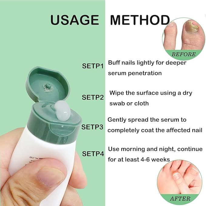 Natural Nail Care Gel, Nutraboost Strengthening Cuticle Serum for Damaged & Brittle Nails, 20ml (1 pcs) (2pcs)