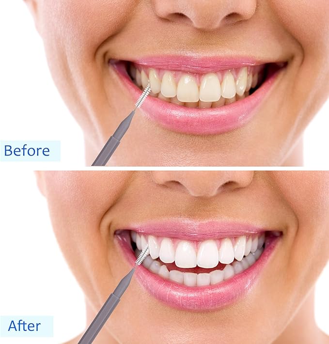 Patelai 100 Pieces Braces Brush for Cleaner Interdental Brush Toothpick Dental Tooth Flossing Head Oral Dental Hygiene Flosser Toothpick Cleaners Tooth Tool(White, Grey,Ideal Size)