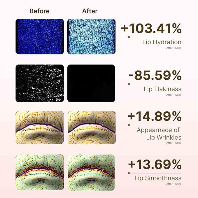 Honey & Collagen Lip Butter, Hydrating Lip Treatment, Overnight Lip Mask, Moisturizing Lip Balm with Jojoba Oil & Squalane, Lip Care, Korean Skin Care (0.45 oz)