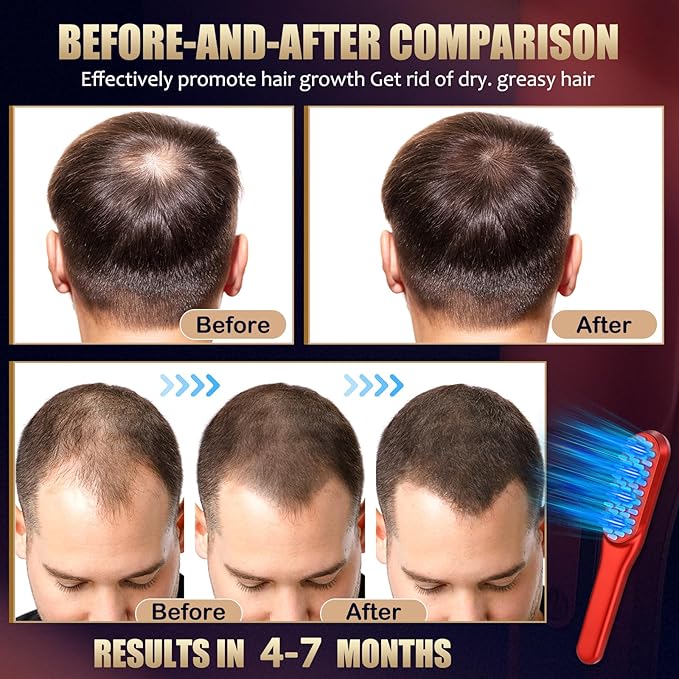 Laser Hair Growth Comb,Red Light Hair Growth Treatment for Men & Women(Red 1pcs )