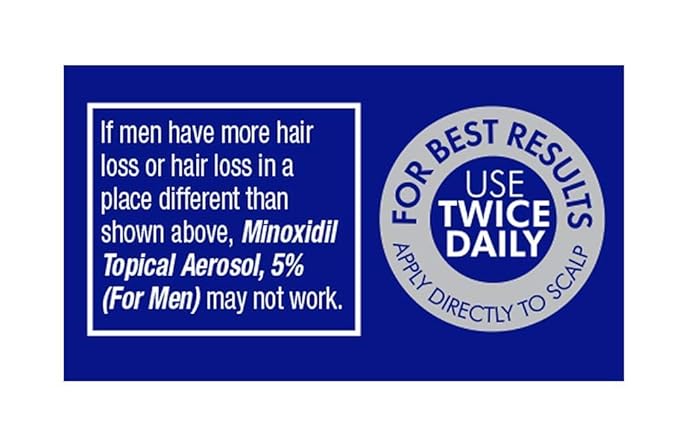 Minoxidil topical aerosol foam, 5%, hair regrowth 2 months treatment for men, 2.11 oz (2 Pack)