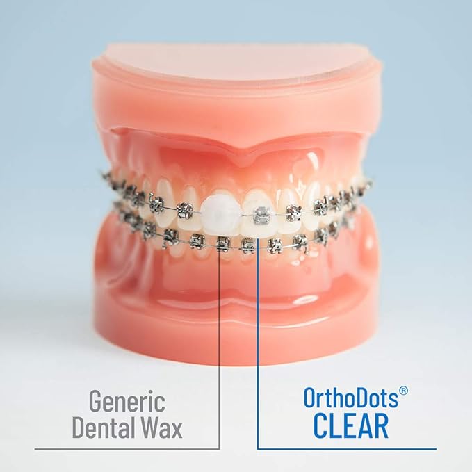 OrthoDots Clear – 24-Hour Protection | Sticks Better Than Dental Wax | Moisture Activated Braces Wax Alternative for Pain Caused by Braces, Clear Aligner Trays, and Other Orthodontic Appliances