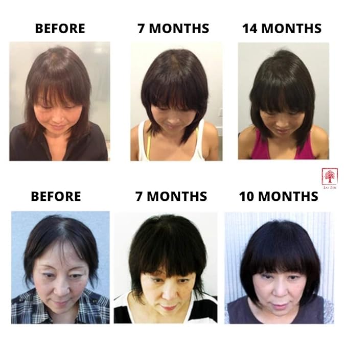 Volume Plus Set | Volumizing Shampoo 8 oz. & Scalp Therapy Spray 4 oz. | Anti-Thinning Formula | Made in USA | Sulfate, Alcohol & Paraben Free