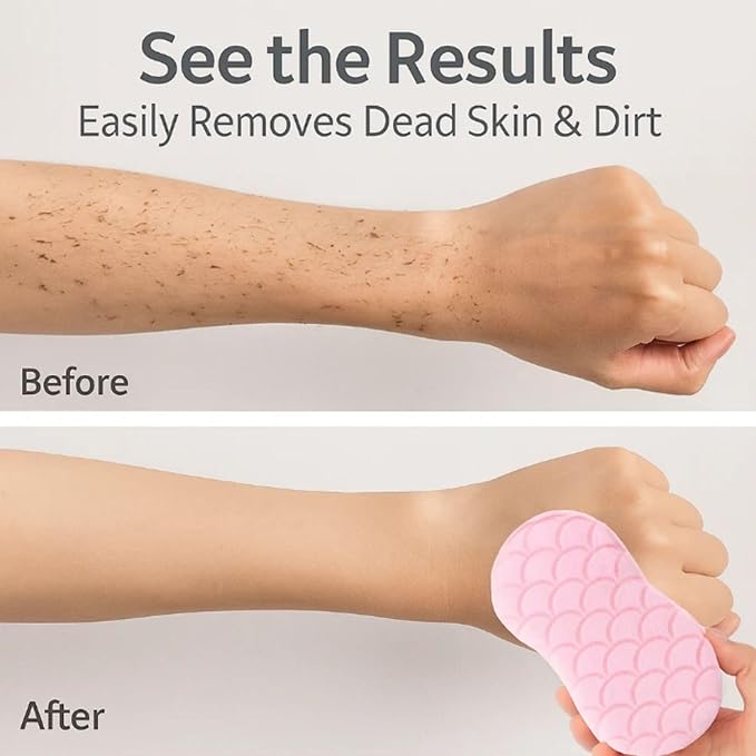 exfoliating Bath Sponge - 3D Super Soft Body Scrub Sponge for Dead Skin Removal, Reusable Skin-Friendly Exfoliator Also a Gentle Bath Sponge for Baby, for Adults, Kids & Pregnant Women (Blue+Pink)