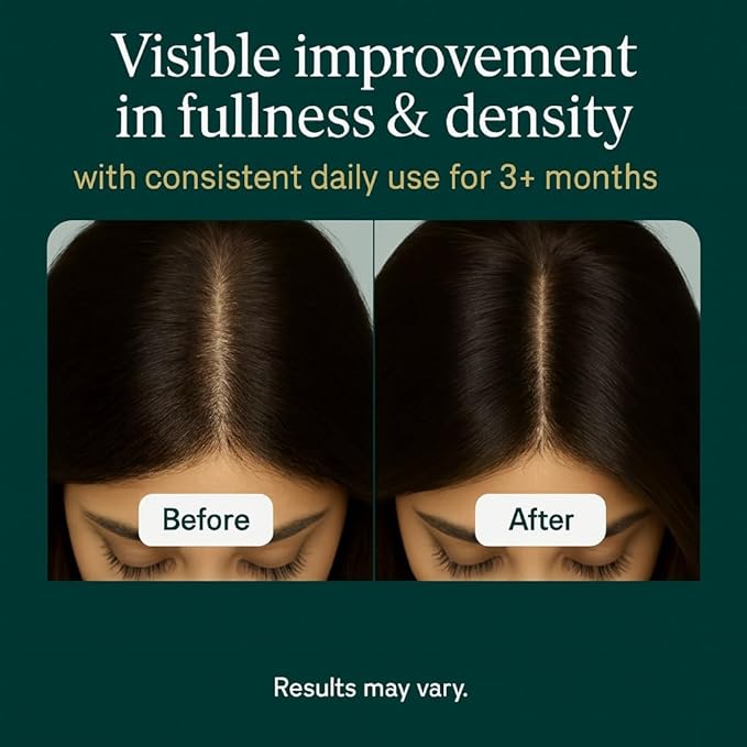 Women’s Hair Growth Skin & Nails Vitamins with Biotin 10,000 mcg, Collagen, Keratin, MSM & Bamboo Extract Drug-Free Formula for Thicker Hair, Strong Nails & Glowing Skin 120 Capsules, 1-Month Supply