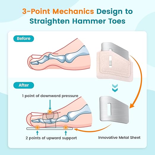 Hammer Toe Straightener Corrector Splint Brace for Women fit 2nd 3rd and 4th Toes - (M-Beige) - 1 Pair