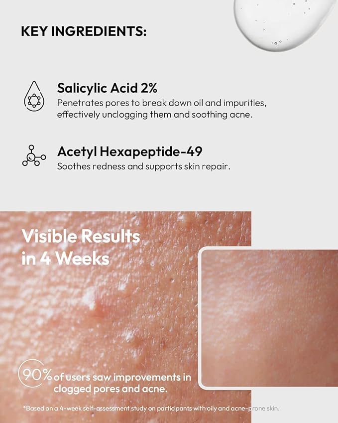 Salicylic Acid 2% Acne Clearing Serum - Treats Blackheads & Blemishes - for Oily & Combination Skin - 1 Fl Oz