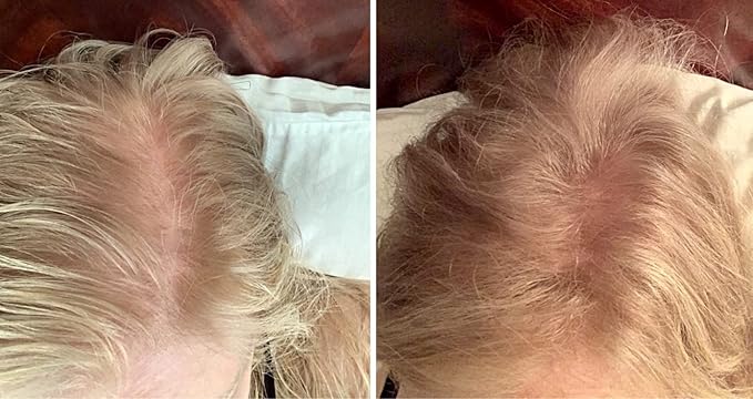 Caboki Value Pack 3, 270-Day Supply, Golden Blonde