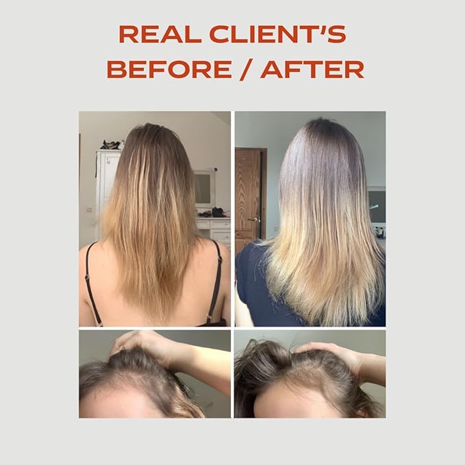 Placenta Hair Loss Shampoo 250ml - Biotech Placenta Hair Growth Shampoo Enriched with Panthenol and Arginine - Advanced Thickening Formula with Proteins and Peptides - Anti Hairloss Treatment