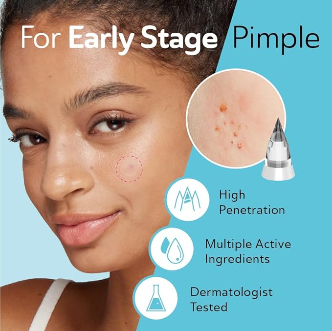 Complete Acne Patch Kit Microdart Early Stage Underground Pimple and Surface Cystic Pimple Support