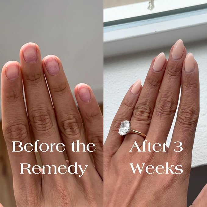 Botanist Nail Rescue Kit | Strengthening Polish + Growth Serum | Grow and Strengthen Nails Damaged from Acrylics, Dip, and Gel Manicures | Non-Toxic, 84% Plant Based, 21-Free & Vegan (Cherry Blossom)