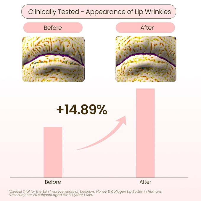 Honey & Collagen Lip Butter, Hydrating Lip Treatment, Overnight Lip Mask, Moisturizing Lip Balm with Jojoba Oil & Squalane, Lip Care, Korean Skin Care (0.45 oz)