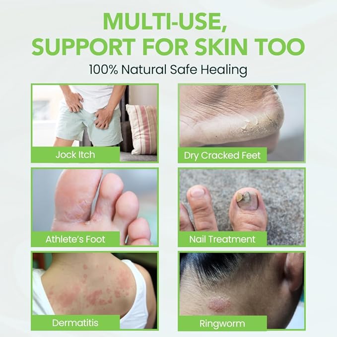 Thena Athletes Foot Cream Extra Strength Herbal Relief with Tea Tree Neem & Menthol, Athletes Foot Treatment Balm for Itchy Dry Cracked Feet, Heels & Toes, Advanced Plant-Based Foot Care