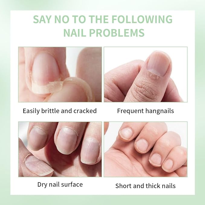 Cuticle Oil Pen for Nail, Natural Nail Strengthener & Growth Treatment, Nail Repair Oil for Damaged Nails, Promotes Nail Growth, Strengthens & Brightens Nails, Nail Care