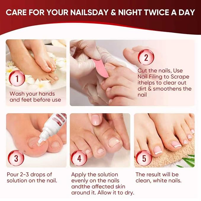 Toenail Treatment,Gentle Formula, Effectively Improves Nails for a More Beautiful Appearance（2pcs）