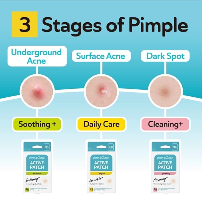 Complete Acne Patch Kit Microdart Early Stage Underground Pimple and Surface Cystic Pimple Support