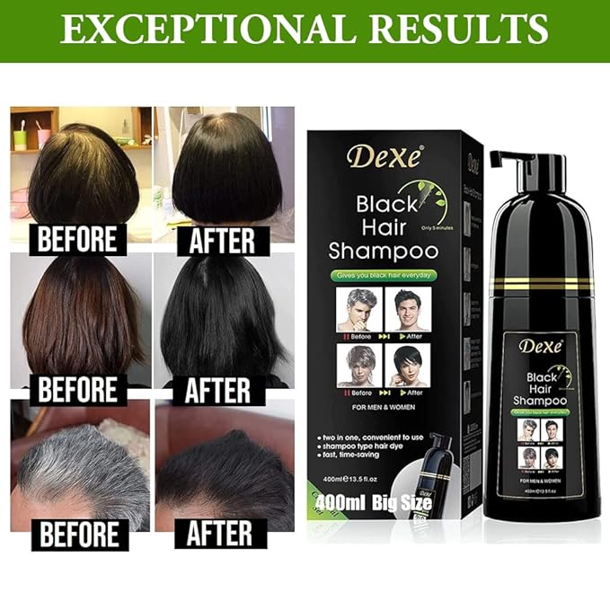 Instant Black Botanical Hair Shampoo - Gentle Ammonia-Free Unisex Formula, 3-in-1 for 100% White Coverage, Lasts 30 Days (Black)
