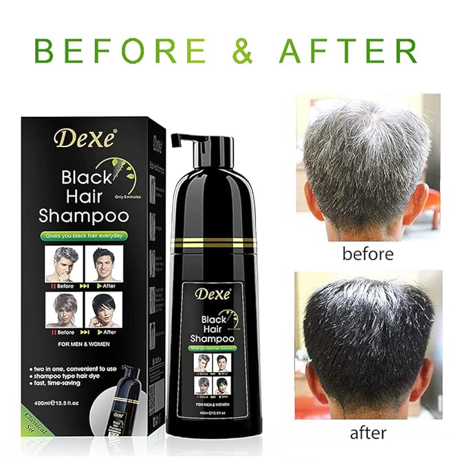 Instant Black Botanical Hair Shampoo - Gentle Ammonia-Free Unisex Formula, 3-in-1 for 100% White Coverage, Lasts 30 Days (Black)