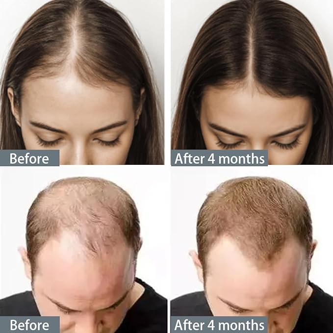 10 in 1 Hair Growth Oil, 10 in 1 Blend with Organic Rosemary, Wild Black Castor Oil & African Powder for Growth, Stronger Longer Hair For Women and Men(2PCS)