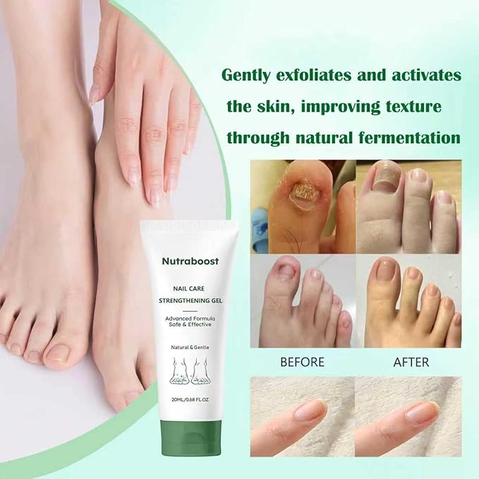 Natural Nail Care Gel, Nutraboost Strengthening Cuticle Serum for Damaged & Brittle Nails, 20ml (1 pcs) (3pcs)