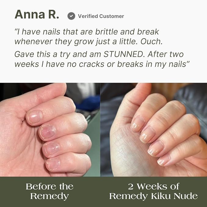 Botanist The Remedy | Nail Strengthening Polish | Repairs & Hardens Nails Damaged from Acrylics, Dip & Gel Manicures | Non-Toxic, 84% Plant Based, 21-Free & Vegan (Nude)