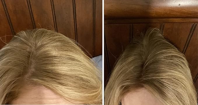 Caboki Value Pack 3, 270-Day Supply, Natural Blonde