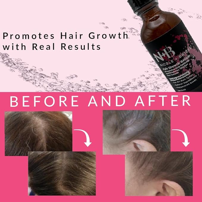 Natural Hair Growth Serum with Biotin, AnaGain, Baicapil, Peppermint Oil