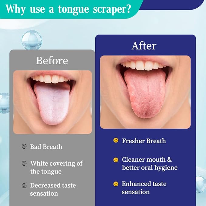 VIWIK 4 Pack Tongue Scraper for Adults, 100% Stainless Steel, Reduce Bad Breath, Tongue Scrubber, Easy to Use, Tongue Cleaner for Oral Care & Hygiene