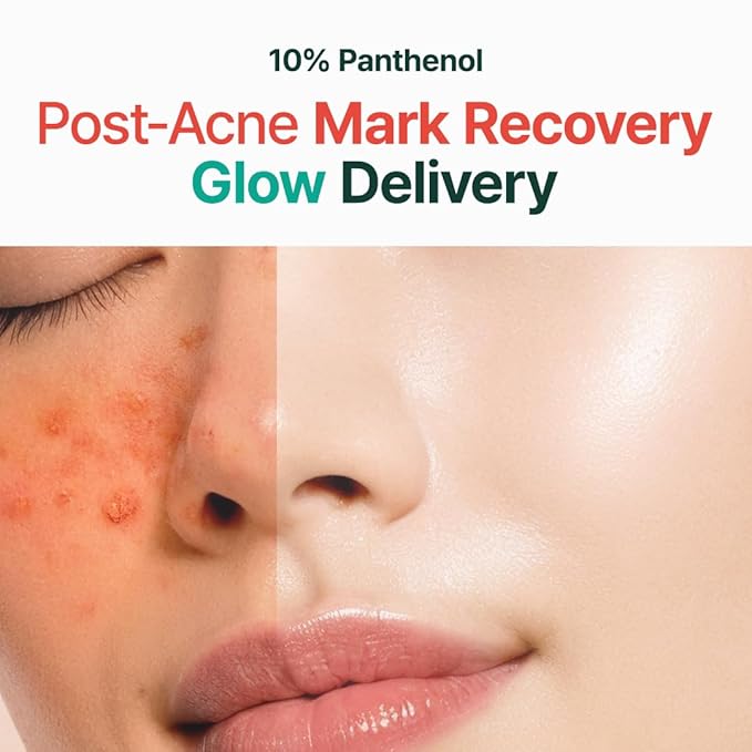 PURITO Panthenol 10% Post-Acne Cream | Moisturizer for Blemish Marks, Barrier Repair | Silicone-Free, Non-Comedogenic, Fragrance-Free, Vegan & Cruelty-free | Korean Skincare, 100mL 3.38 fl.oz