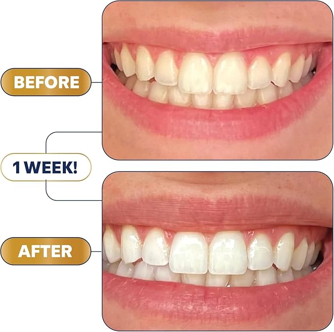 Lumineux Teeth Whitening Strips Kit - 9 Treatments - Peroxide Free - Enamel Safe for Whiter Teeth - Whitening Without The Sensitivity - Dentist Formulated - Sensitivity Free