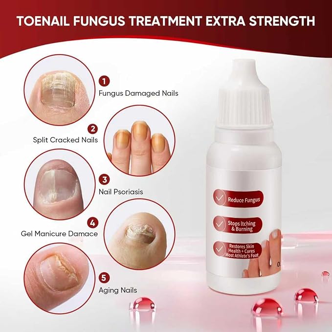 Toenail Treatment,Gentle Formula, Effectively Improves Nails for a More Beautiful Appearance（2pcs）