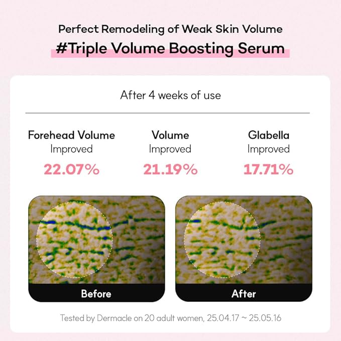 PDRN Firming Bouncy Boost Serum -Supports Skin Elasticity & Smooth, Water-Like Capsule Complex with Vegan Collagen, Bakuchiol & Retinol, Refined Texture, K-Beauty Serum (30ml)