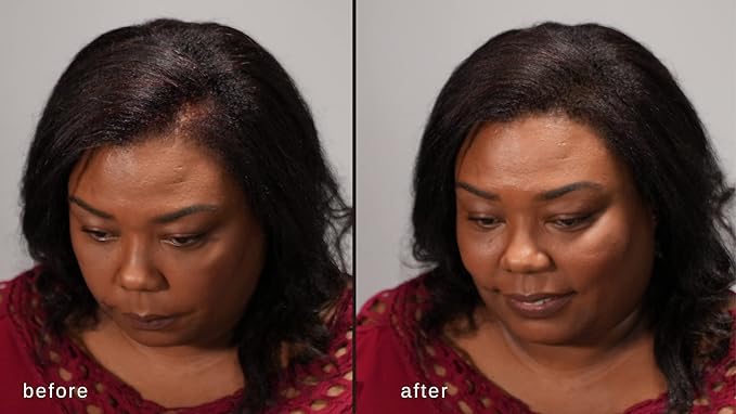 Volumizing Hair Fibers with real Keratin for Thinning Hair/Hair Loss – Dermatologist Tested and Certified Hypoallergenic - 60 days + supply - Multiple Colors Available (Gray)