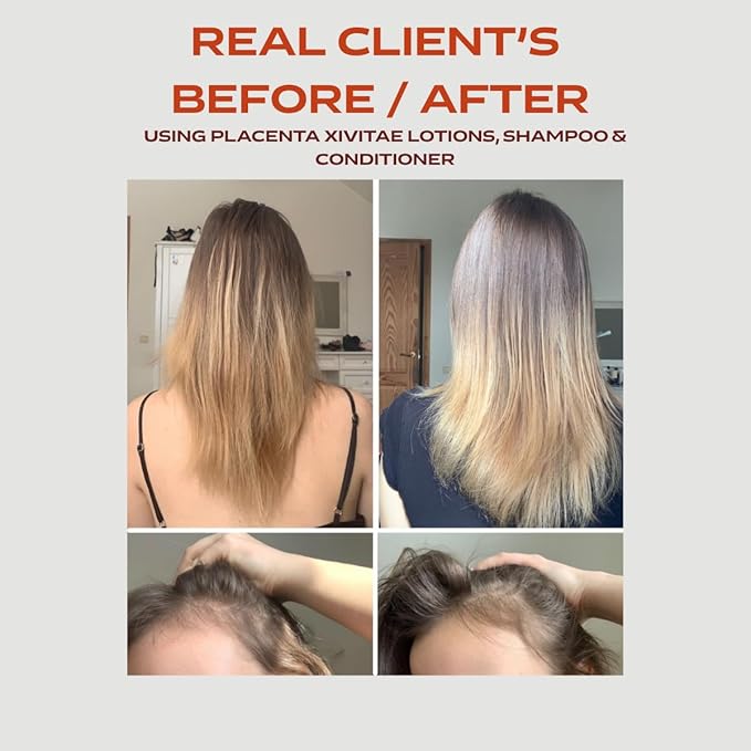 Conditioner for Damaged Hair Fall Prevention with Biotech Placenta 250 ml - Moisturizing and Strengthening - Professional Deep Hair Conditioner with Organic Hazelnut Extract and Panthenol
