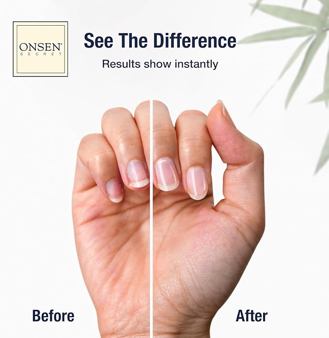 Onsen Secret Complete Nail Reboot Kit w/Cuticle Oil 10ml, Nail File 120/180 Grit Double Sided, A 3-Way Buffer Block & Cuticle Serum-15ml in Action | Super Value Pack