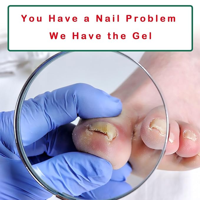 Nutraboost Nail Fungus Treatment Gel - 2 PCS Nail Growth Repair Cream for Fingernails and Toenails, Fix & Renew Damage Fungal Nail, Broken, Cracked & Discolored Nails