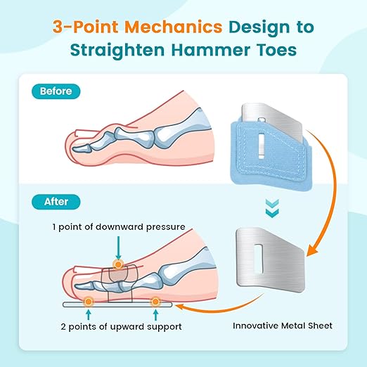 Hammer Toe Straightener Corrector Splint Brace for Women fit 2nd 3rd and 4th Toes - (M-Blue) - 1 Pair