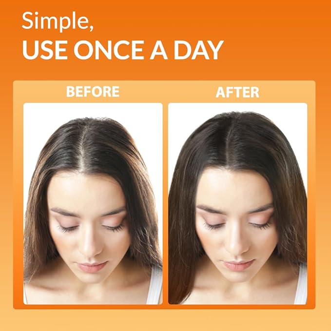 Youthfully Beautiful Rice Nutri Spray and Shampoo Bar Set Thickens Hair Supports Healthy Growth Rice Coffee Extract for Thinning Hair and Hair Loss Natural Cleanser Scalp Treatment