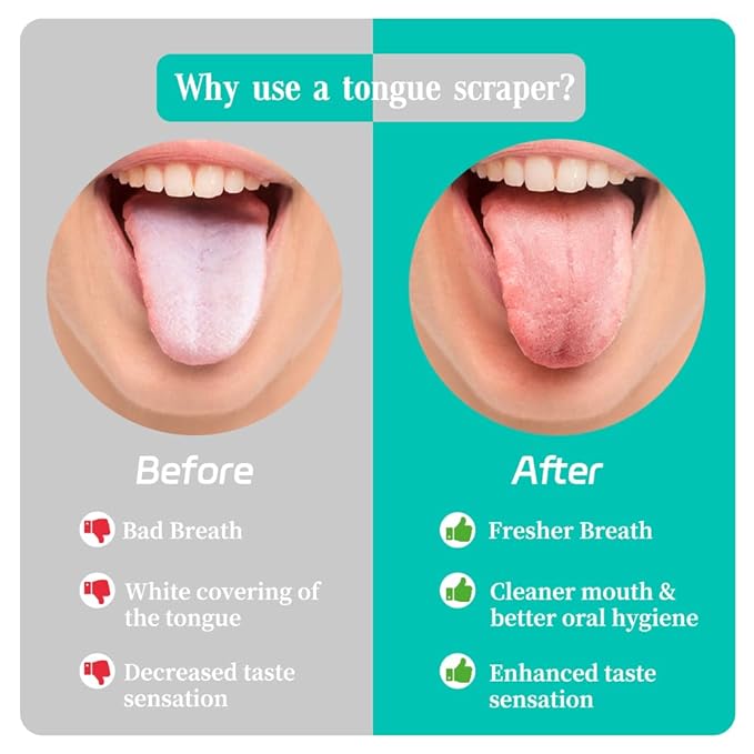 VIWIK 6 Pack Tongue Scraper for Adults Bad Breath Treatment for Adults 100% Stainless Steel Reduce Bad Breath Tongue Scrubber Easy to Use Tongue Cleaner for Oral Care & Hygiene