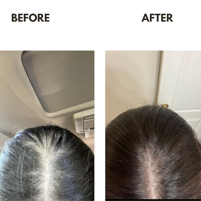 ZAIN1 Natural Hair growth serum with Snail Mucin, Rosmary, Niacinamide, Hyaluronic acid, Azelaic acid, Nettle, and Much More Natural Ingredients (Mimosa, 3.4 oz). Our products are made by nature