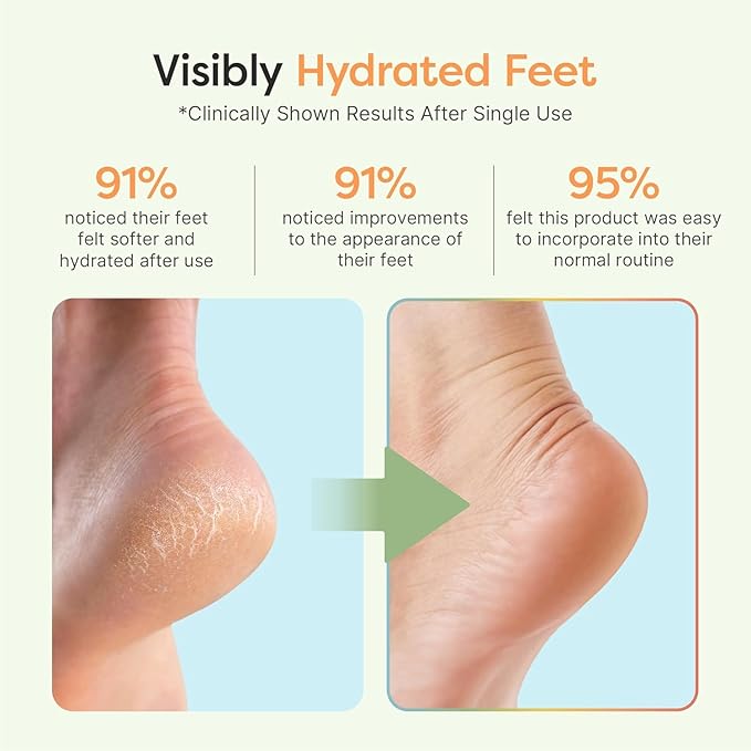 ZenToes Moisturizing Socks for Cracked Heel Treatment, Vitamin E, Olive Oil and Jojoba Oil Heel Socks, Stocking Stuffers for Women, Spa Self Care Gifts for Women (White & Blue Snowflake, Regular)