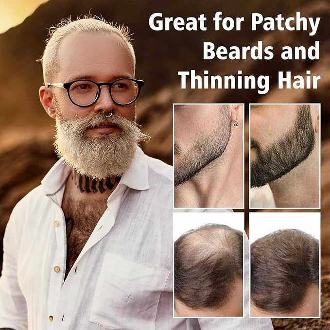Root Cover Up Powder for Women - Medium Brown Hairline Powder for Bald Spots, Eyebrows, Beard Line, Light-Blonde Hair Fibers for Thinning Hair Shadow Powder 2 Pack