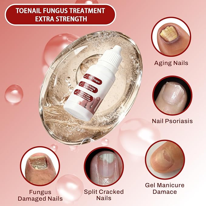Fungi Nail Toenail Treatment Extra Strength,Toenail Renewal Serum, Nail Conditioning Solution for Thick&Discolored Nails, Quick-Dry Dropper, Safely & Gently for Healthier Nails,