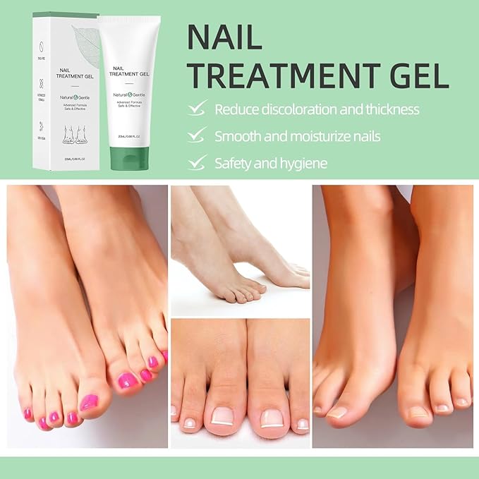 2Pcs Natural Nail Repair Gel, Nail Growth Repair Cream, Multi Purpose Nail Repair Foot Care Cream.