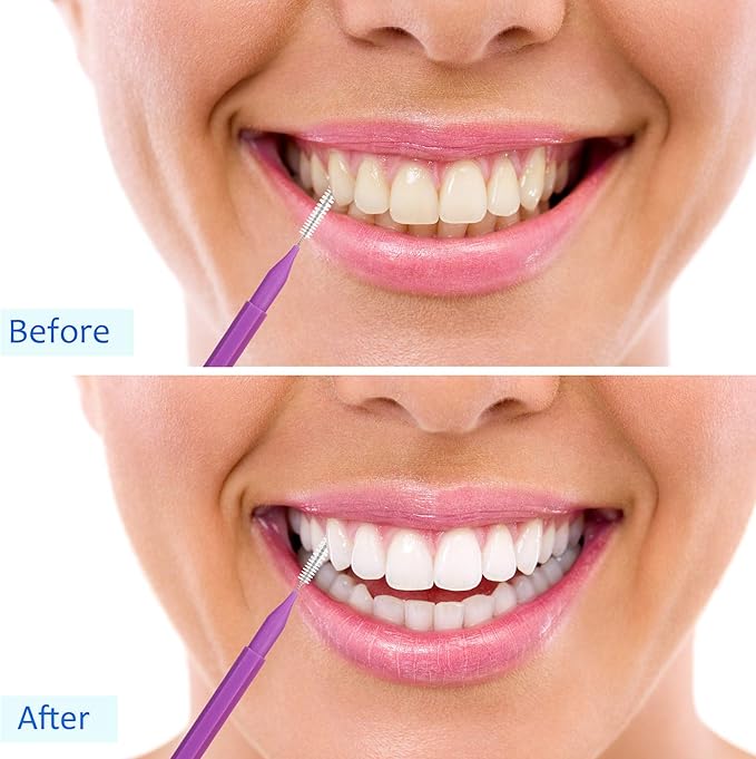 Patelai 100 Pieces Braces Brush for Cleaner Interdental Brush Toothpick Dental Tooth Flossing Head Oral Dental Hygiene Flosser Toothpick Cleaners Tooth Tool