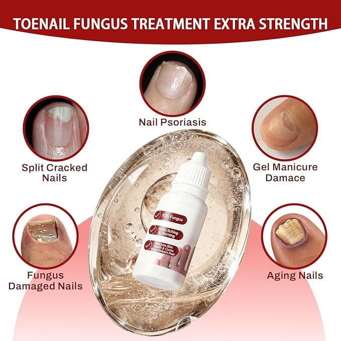 DERMFREE Fungi Nail Toenail Treatment,Gentle Formula, Effectively Improves Nails for a More Beautiful Appearance