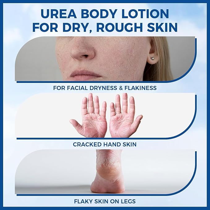 40% Urea Foot Cream with 2% Salicylic Acid, Urea Cream 40 Percent for Feet & Hands-Maximum Strength Moisturizer for Rough, Dry, Thick & Cracked Skin, Deep Hydration, Non-Greasy, 5.29 oz