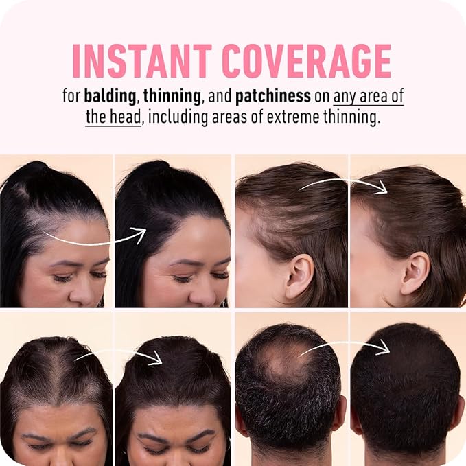 BOLDIFY Hairline Powder (LARGE, 10g) - Root Touch Up Hair Color for Gray Coverage - Bald Spot Concealing Hair Powder for Women & Men - 24-Hour Stain-Proof - Gray