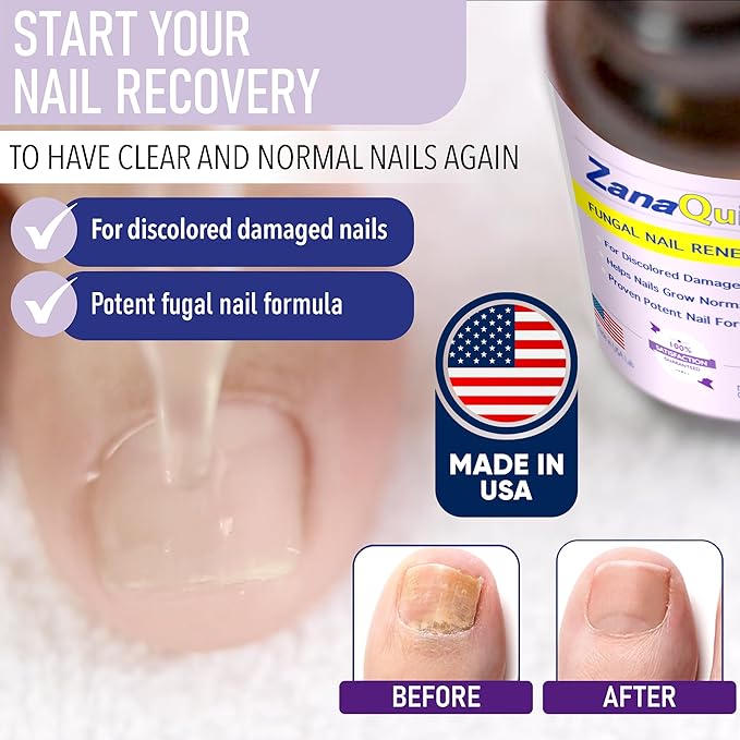 ZanaQuick 3 Step Toenail Solution. Extra Strength Damaged Nail Solution. Complete Repair Kit for Discolored Brittle Nails. Nail Renewal Drops, Nail Disruptor and Deep Foot Soak Cleanser