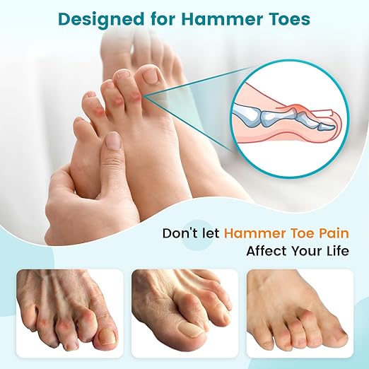 Hammer Toe Straightener Corrector Splint Brace for Women fit 2nd 3rd and 4th Toes - (L-Beige) - 1 Pair